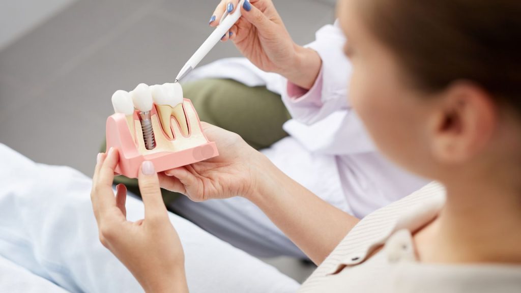 Role of Dental Implants in Restoring Your Smile