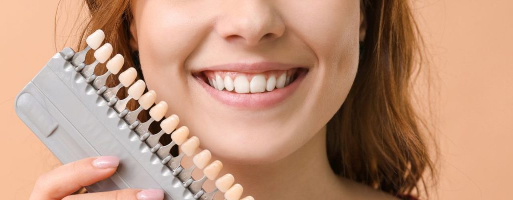 Transform Your Smile with Veneers in Gisborne