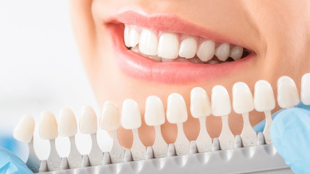 Consider a Smile Makeover with Gisborne Smiles