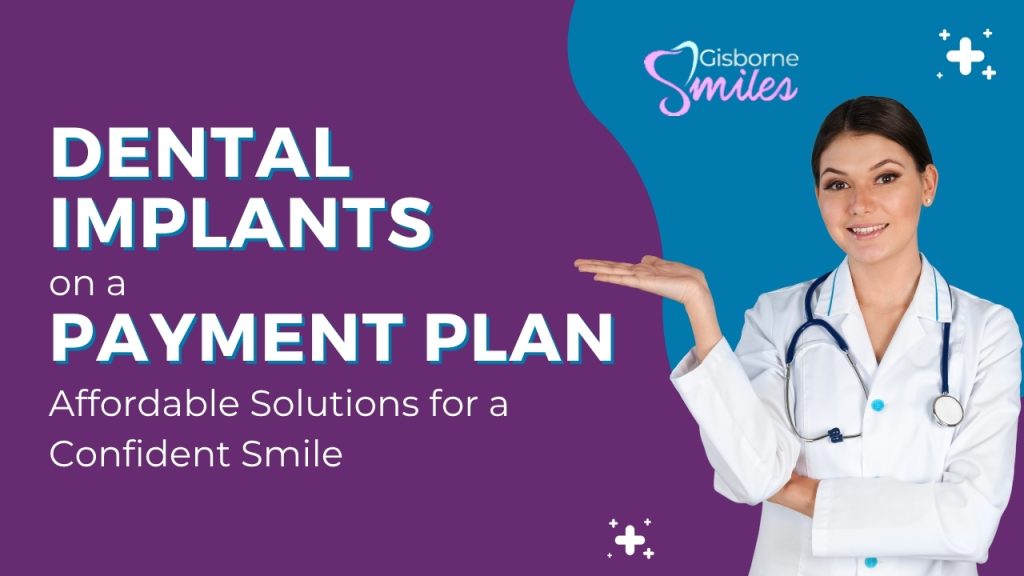 Dental Implants on a Payment Plan: Affordable Solutions for a Confident Smile
